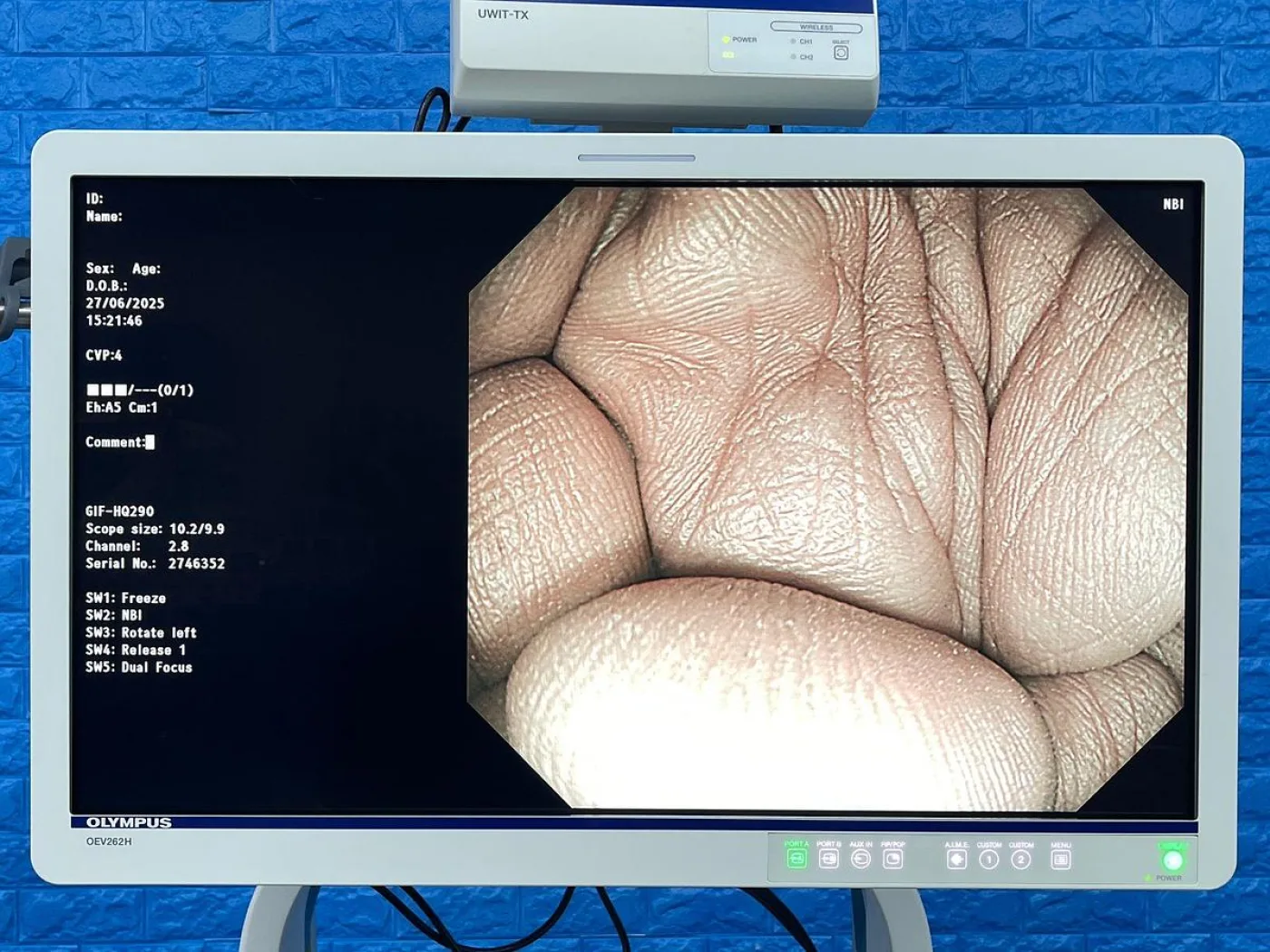 Olympus GIF-HQ290 Gastroscope - 3