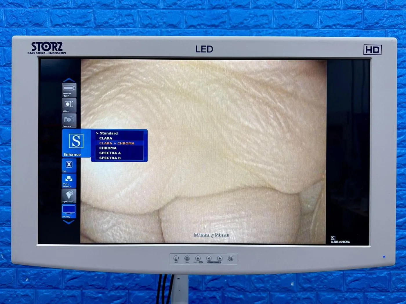 Karl Storz 13925 PKS Colonoscope - 5