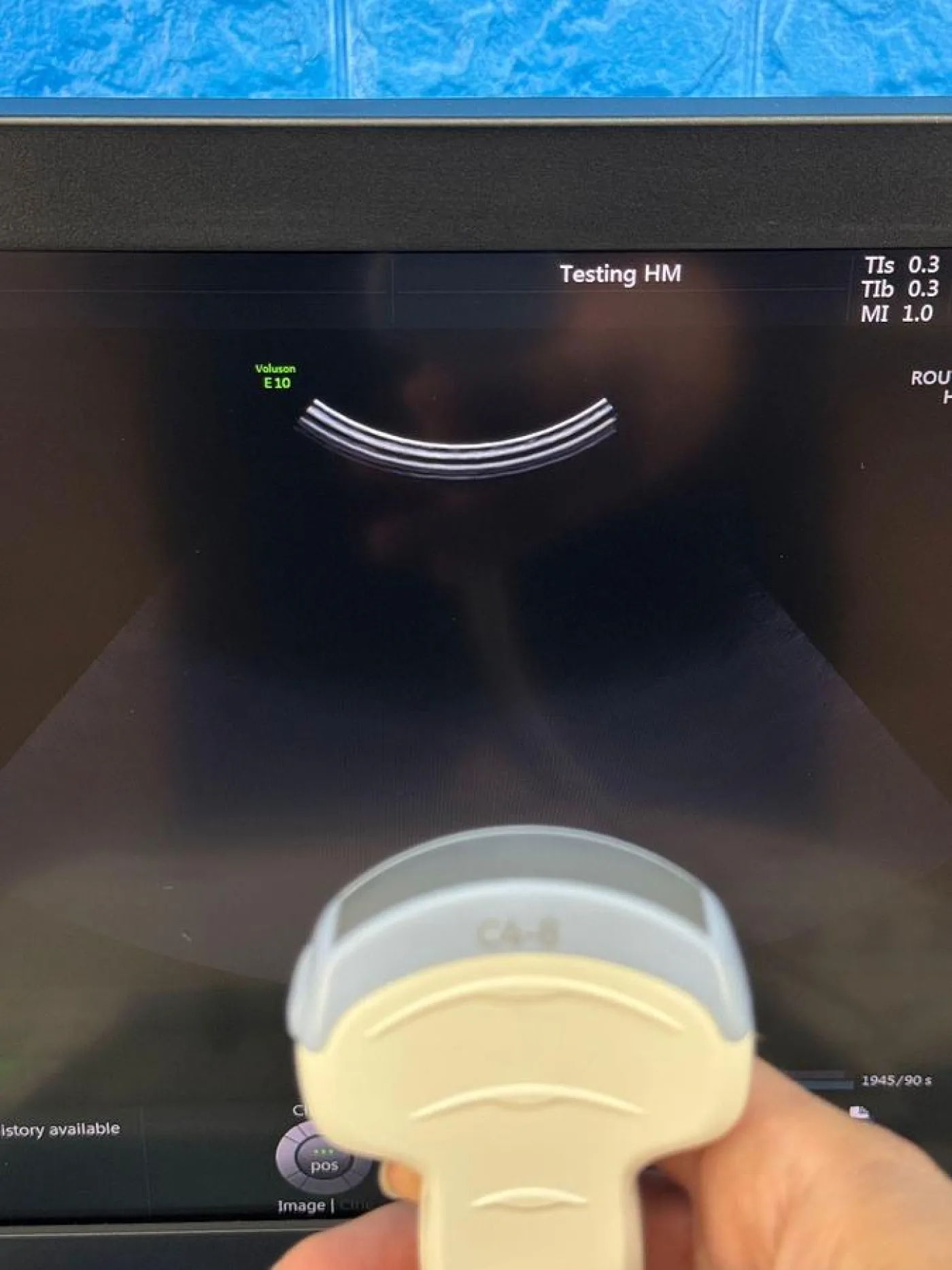 For Sale GE Voluson E10 BT17 Ultrasound System (2017) OLED | 4D OB/GYN Ultrasound - 7