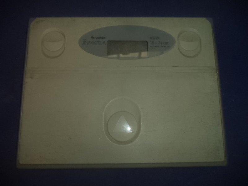 X-Omatic cassette (Gebraucht, sehr gut)
