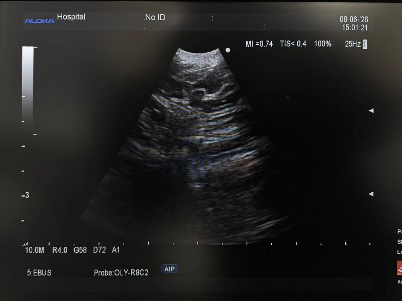 Olympus BF-UC260FW Linear Ultrasound Bronchoscope EBUS - 8