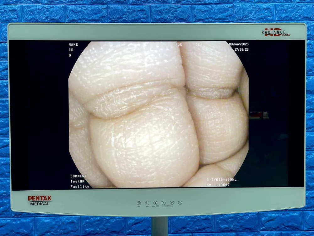 Pentax Scope Model: G-EYE38-i 10NL YOM: 2019 Colonoscope, 36 Times Used.