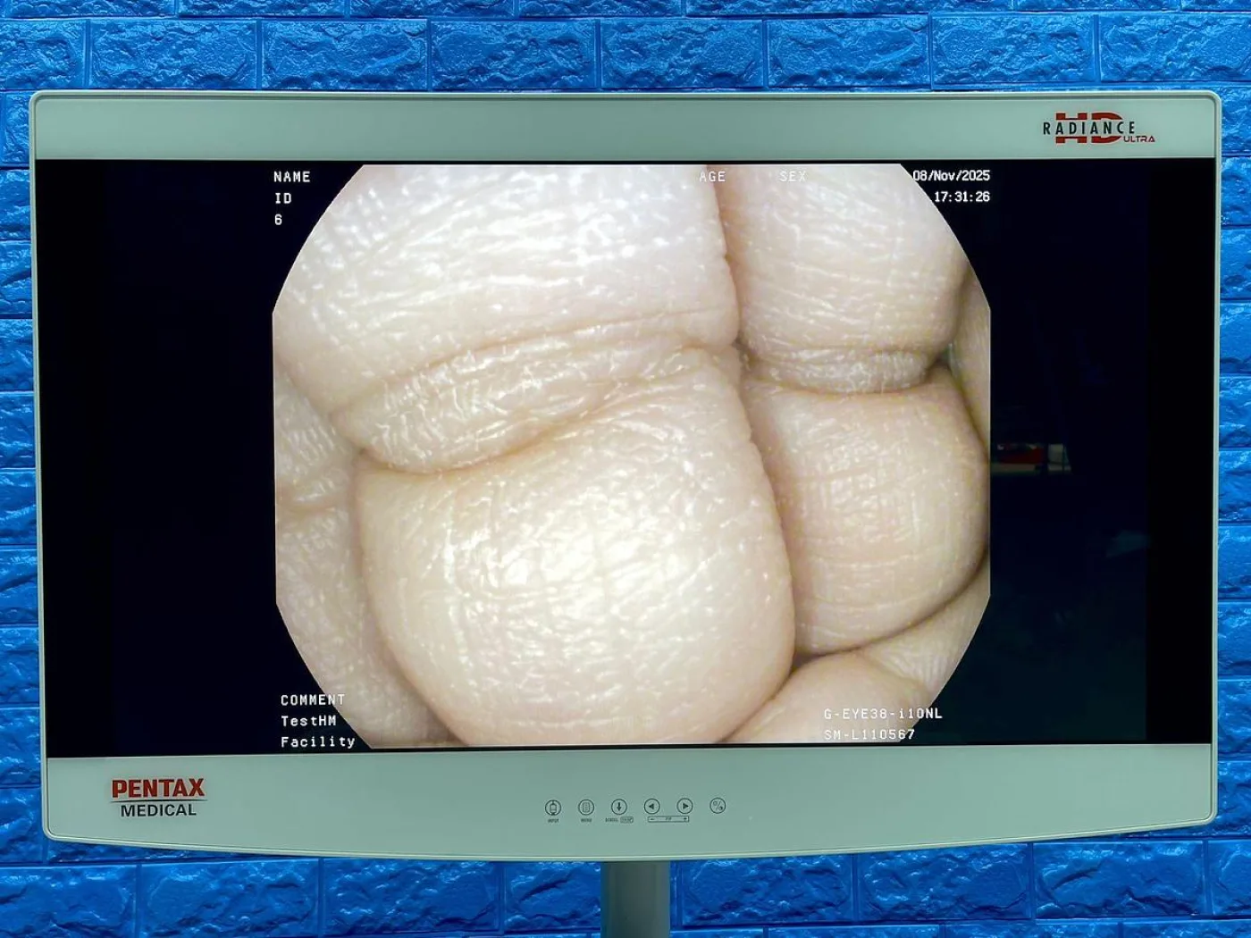 Pentax Scope Model: G-EYE38-i 10NL YOM: 2019 Colonoscope, 36 Times Used. - 1