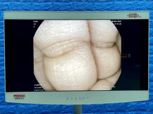 Pentax Scope Model: G-EYE38-i 10NL YOM: 2019 Colonoscope, 36 Times Used.