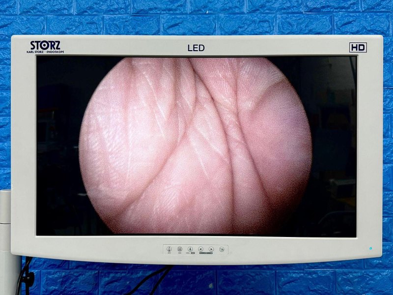 Olympus 30° Optic Model: A4674A