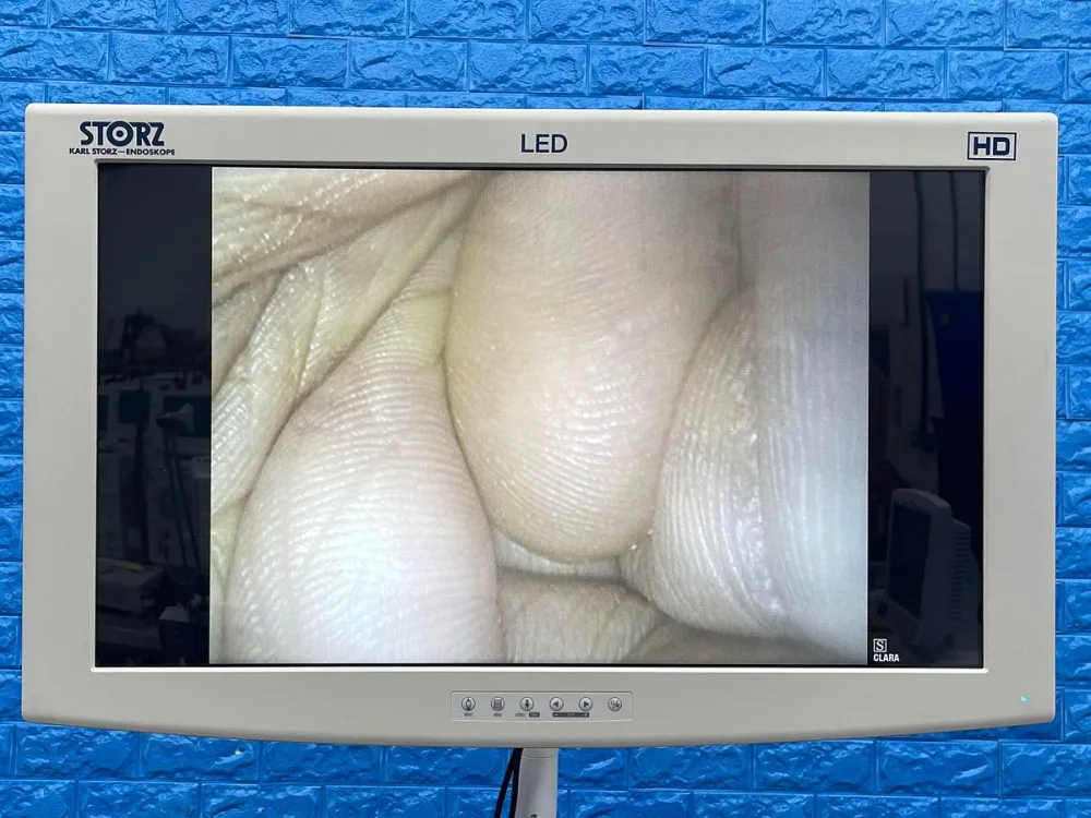 Karl Storz 13925 PKS Colonoscope