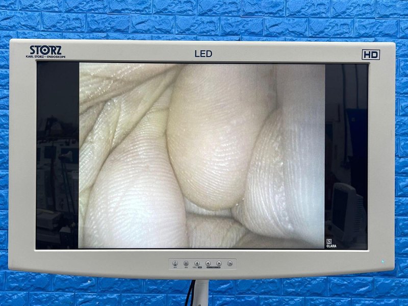 Karl Storz 13925 PKS Colonoscope