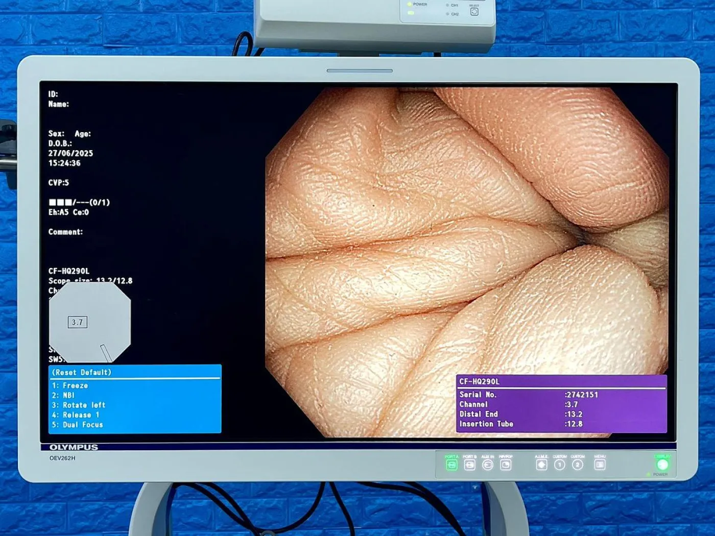 Olympus CF-HQ290L Colonoscope - 1