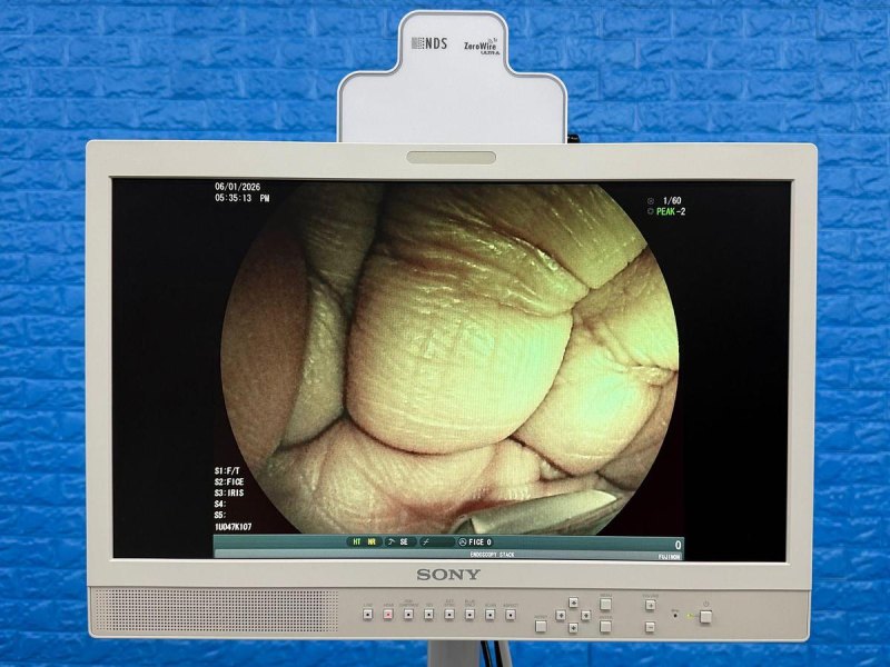 Fujinon Scope EG-580 UT Linear Ultrasonic Endoscope