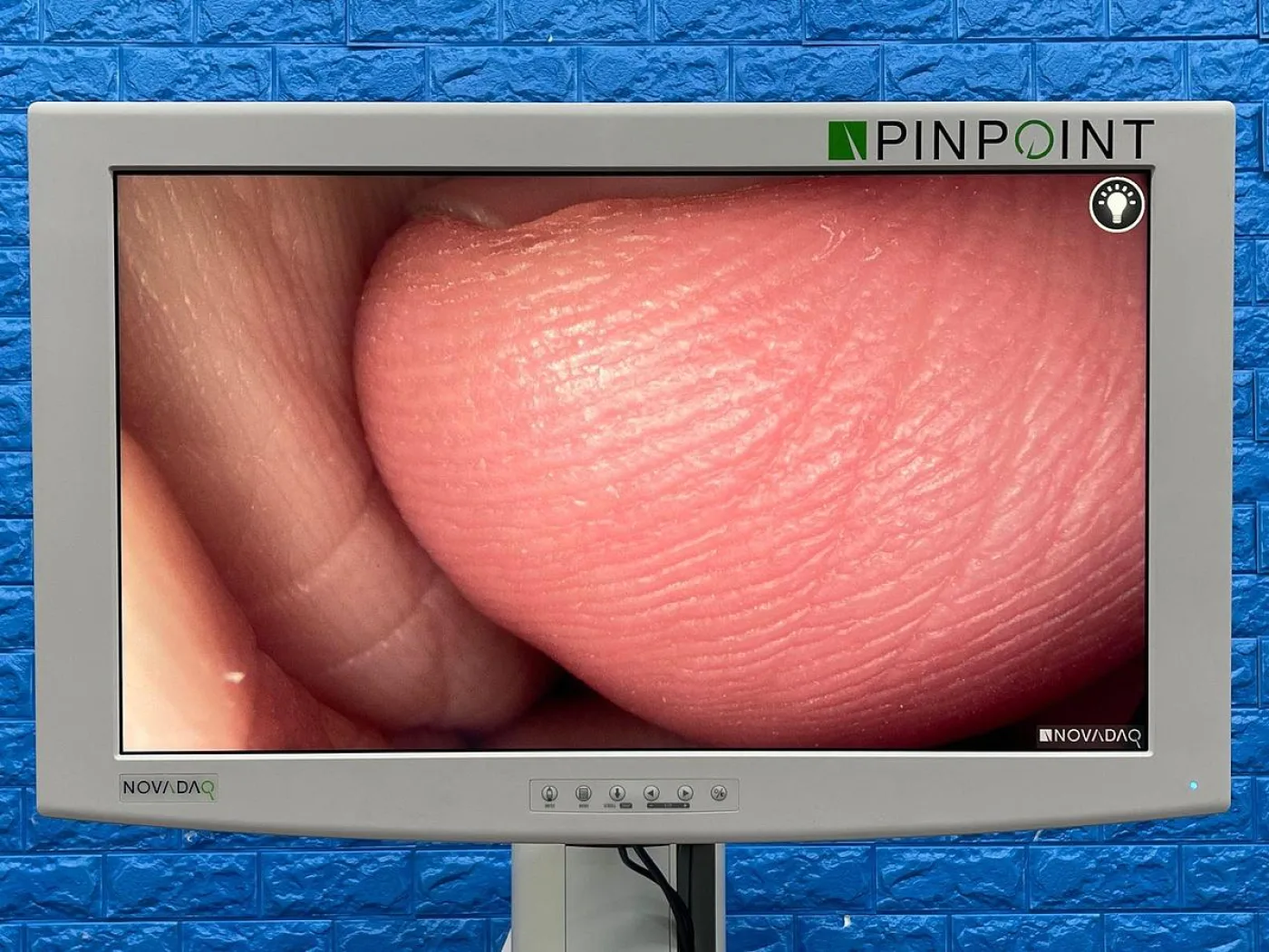 Pinpoint Laparoscopy Tower YOM: 2018 - 8