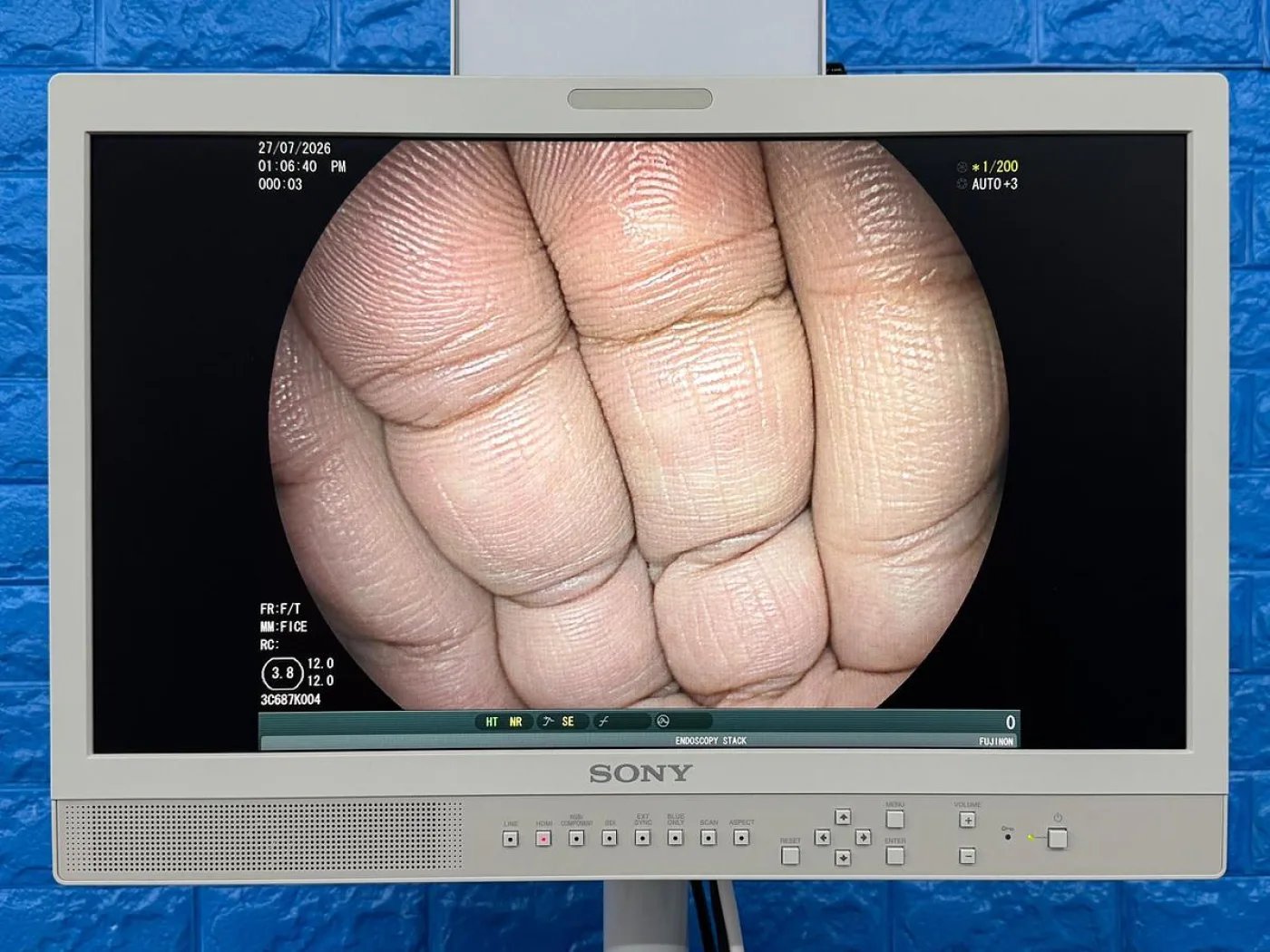 Fujinon Scope Model: EC-600WM - 2