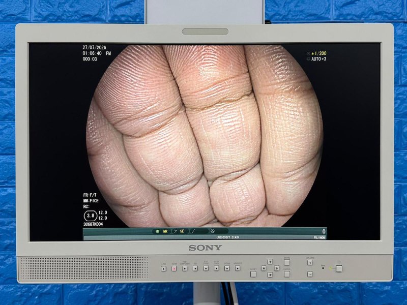 Fujinon Scope Model: EC-600WM