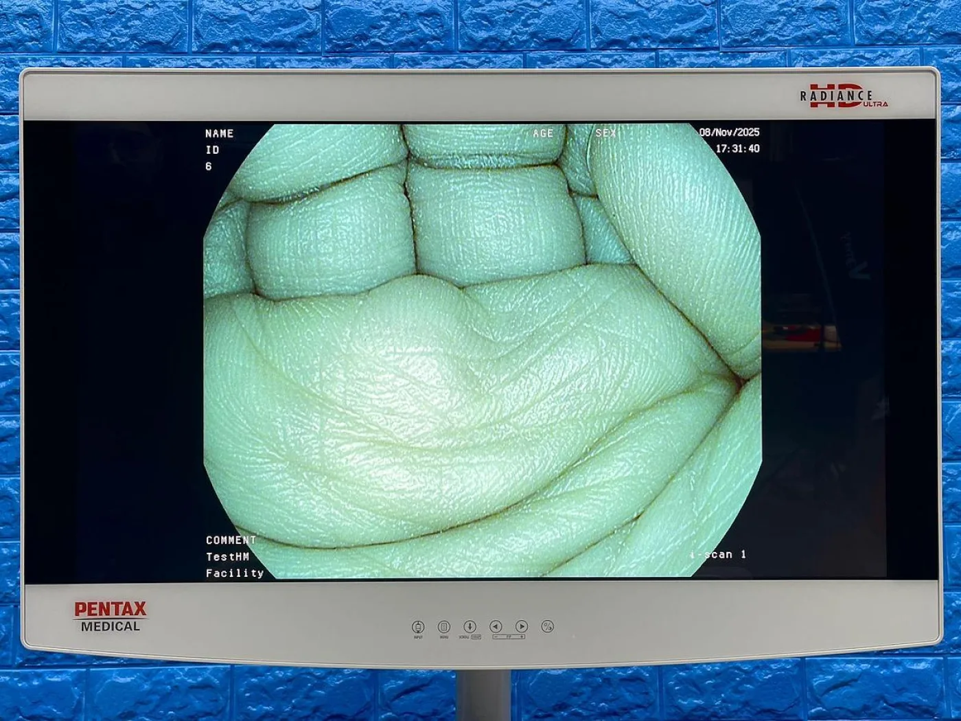 Pentax Scope Model: G-EYE38-i 10NL YOM: 2019 Colonoscope, 36 Times Used. - 3