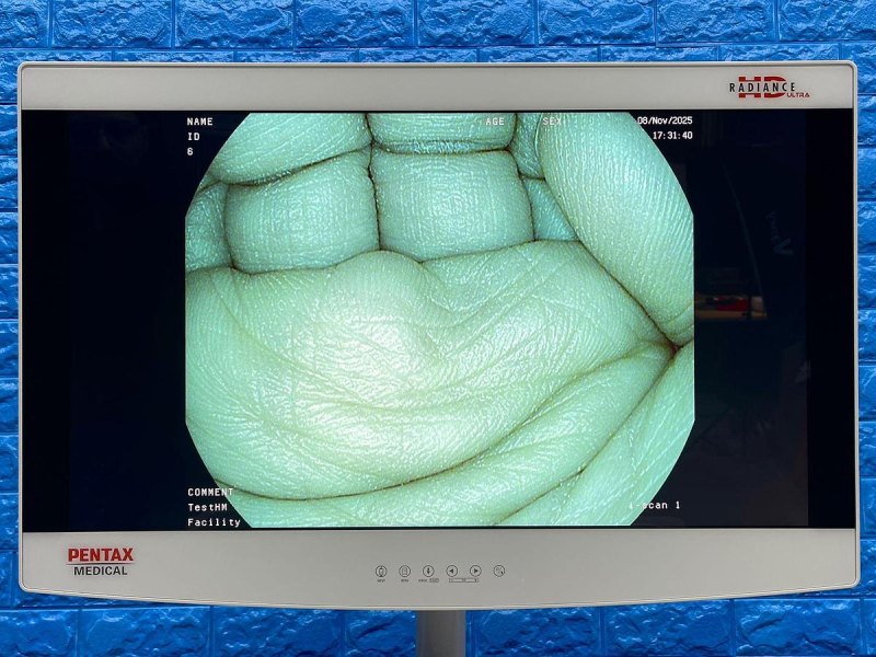 Pentax Scope Model: G-EYE38-i 10NL YOM: 2019 Colonoscope, 36 Times Used.