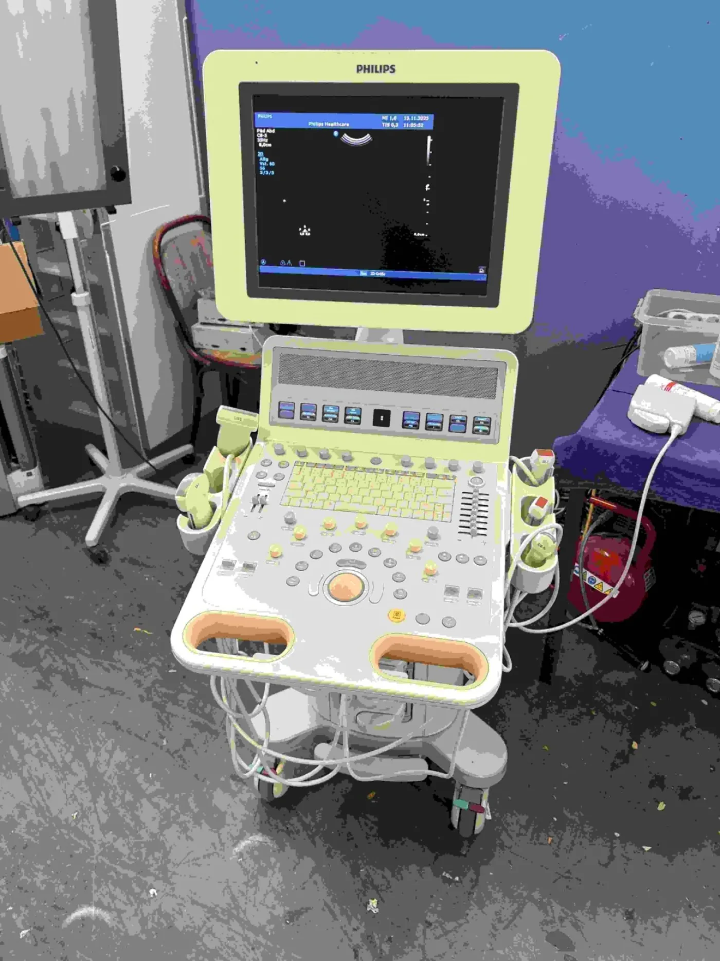 Acuson X150 (Gebraucht, sehr gut) - 8