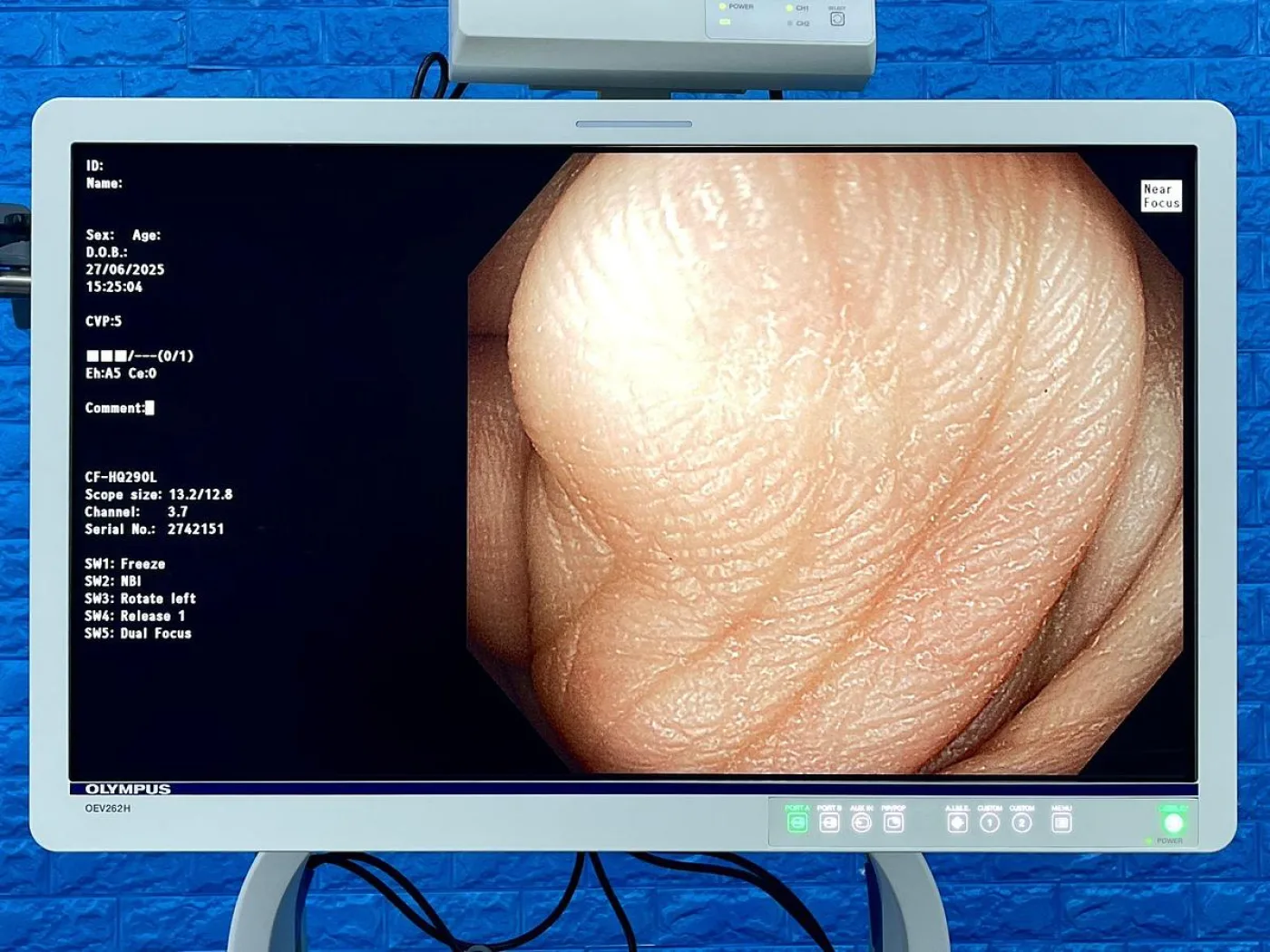 Olympus CF-HQ290L Colonoscope - 5