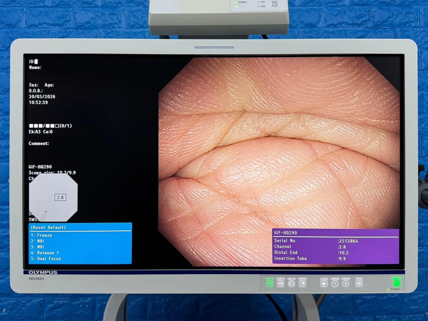 Olympus Scope Model GIF HQ290 Gastroscope - 1