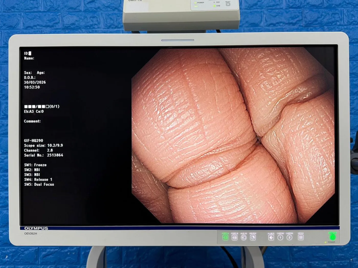 Olympus Scope Model GIF HQ290 Gastroscope - 2