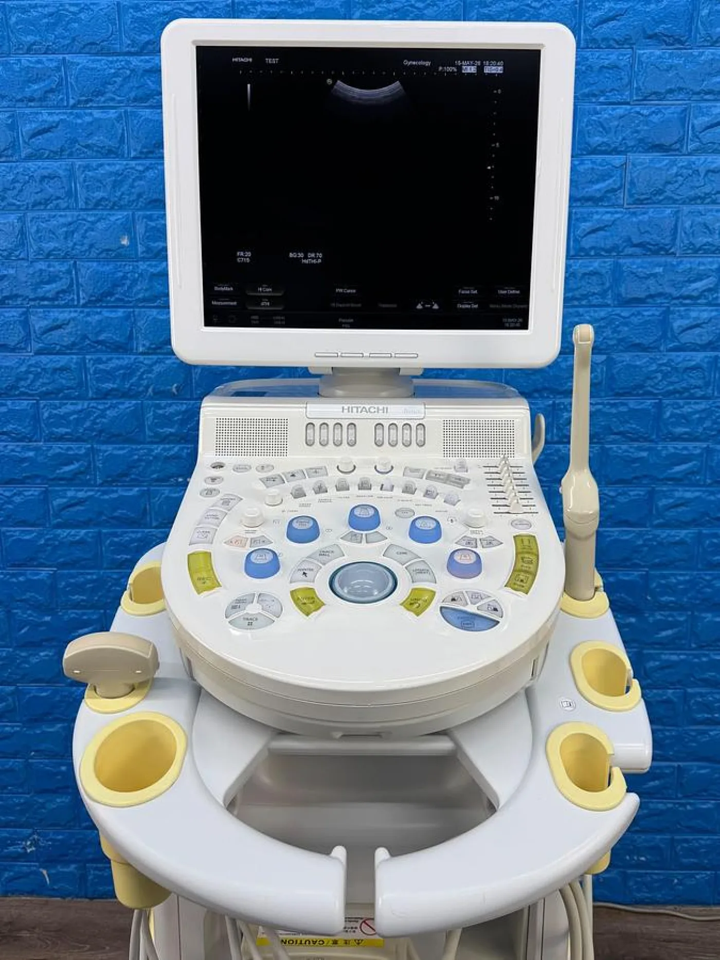 Hitachi HI Vision Avius Ultrasound YOM: 2011 - 4