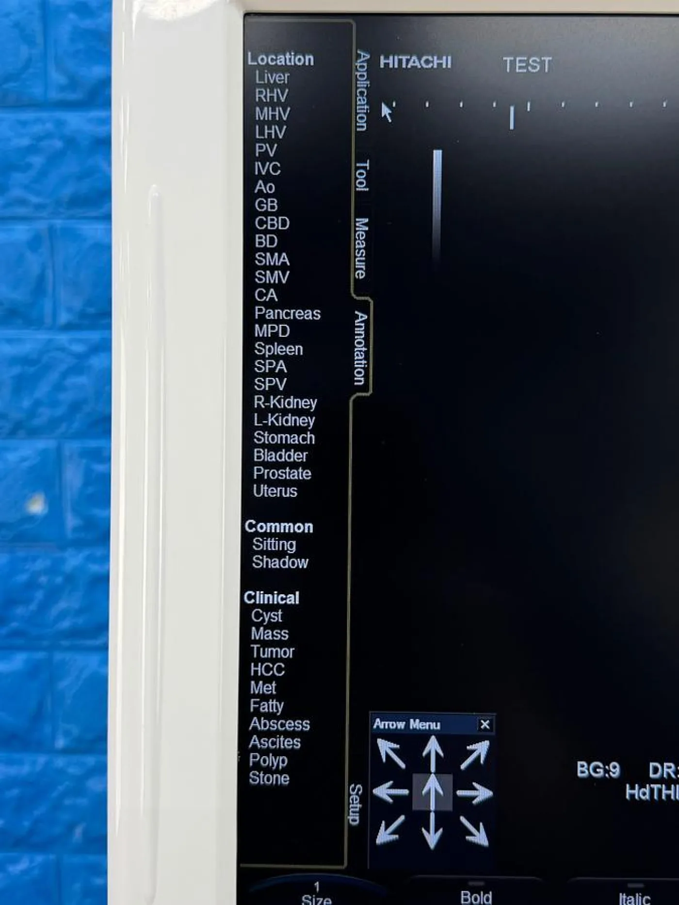 Hitachi HI Vision Avius Ultrasound YOM: 2011 - 8
