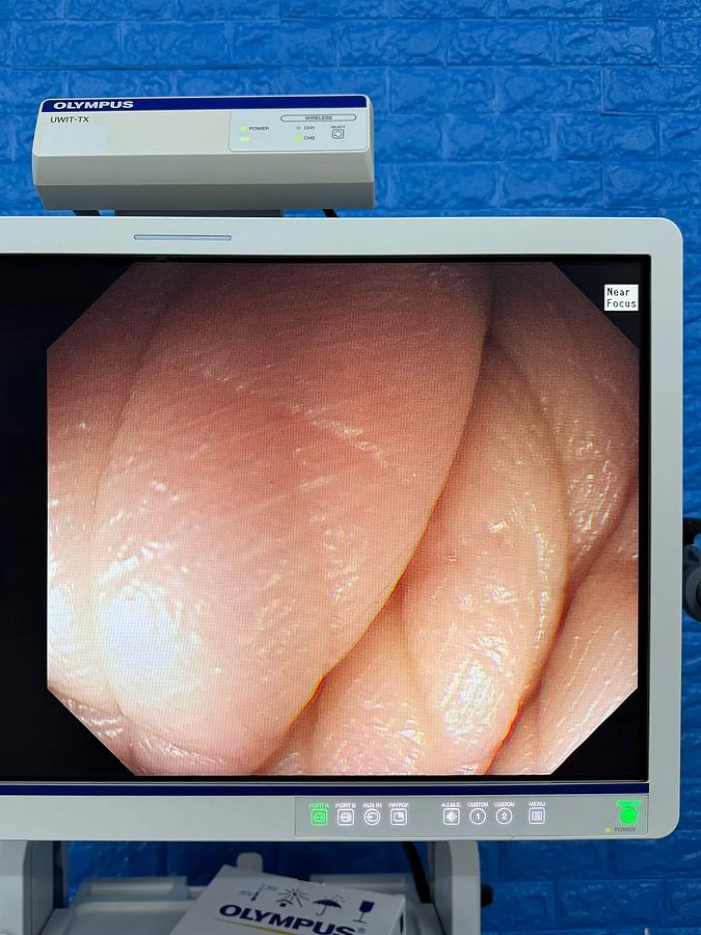 Olympus Scope Model GIF HQ290 Gastroscope - 4