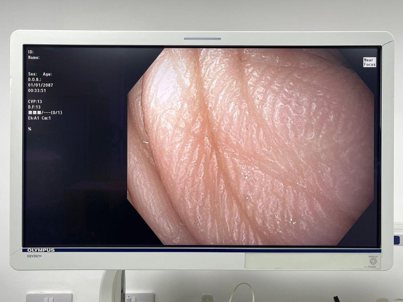 Olympus GIF HQ190 Gastroscope