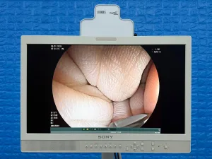 Fujinon Scope EG-580 UT Linear Ultrasonic Endoscope YOM: 2018