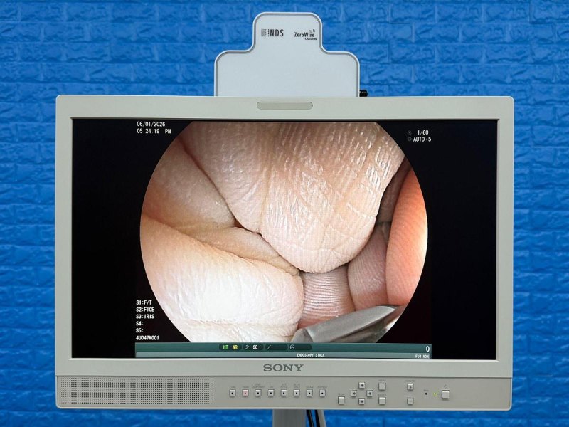Fujinon Scope EG-580 UT Linear Ultrasonic Endoscope YOM: 2018