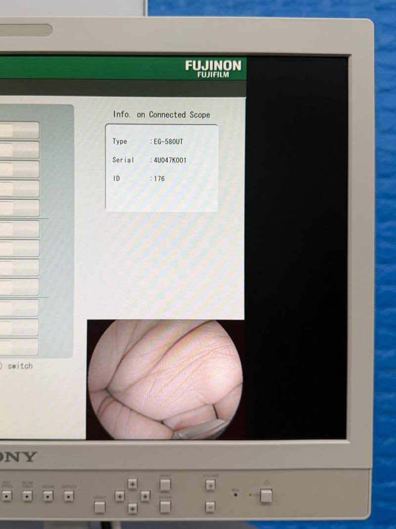 Fujinon Scope EG-580 UT Linear Ultrasonic Endoscope YOM: 2018