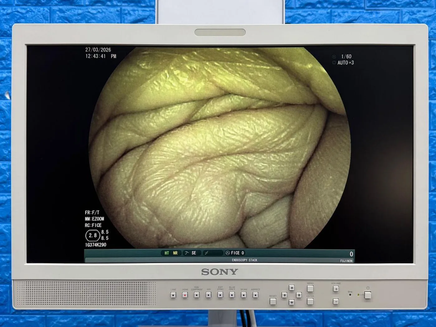 Fujinon Scope Model: EG-530FP Gastroscope - 4