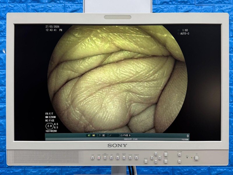 Fujinon Scope Model: EG-530FP Gastroscope