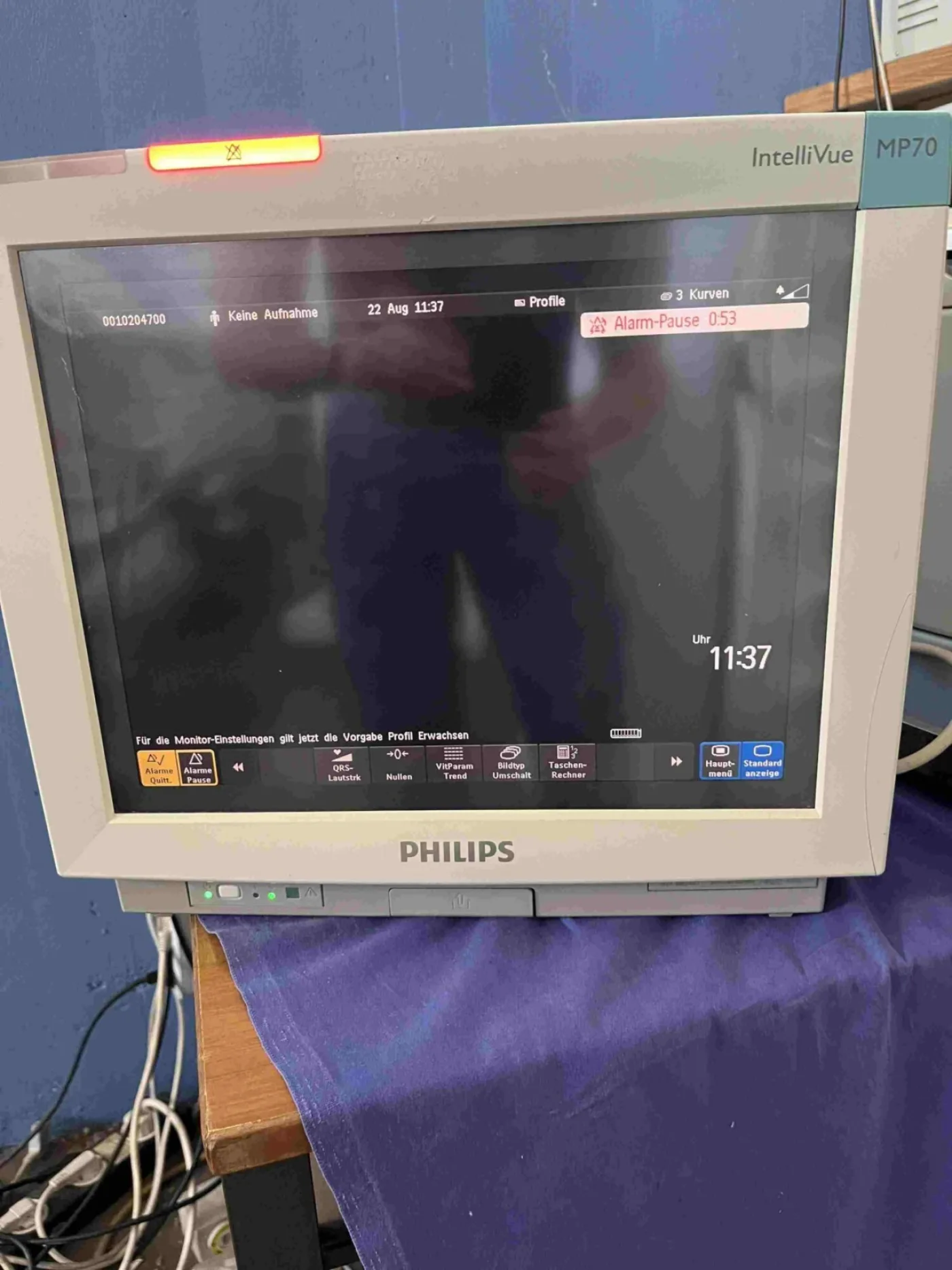 Intellivue MP70 (Gebraucht, sehr gut) - 5