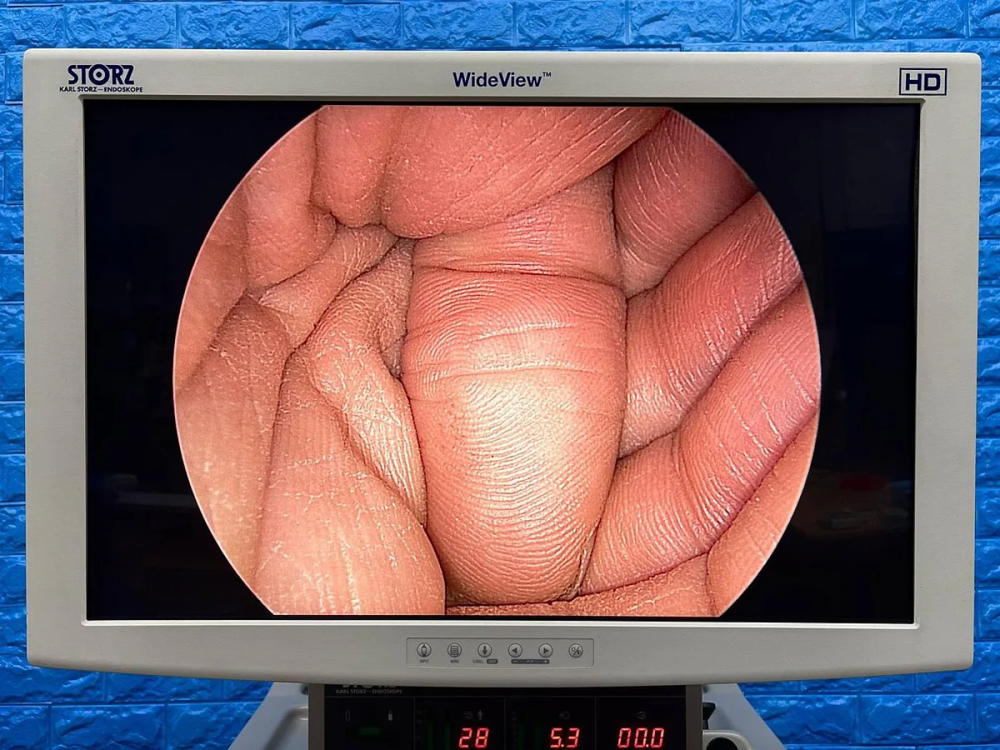Karl Storz Laparoscopy Tower - 8