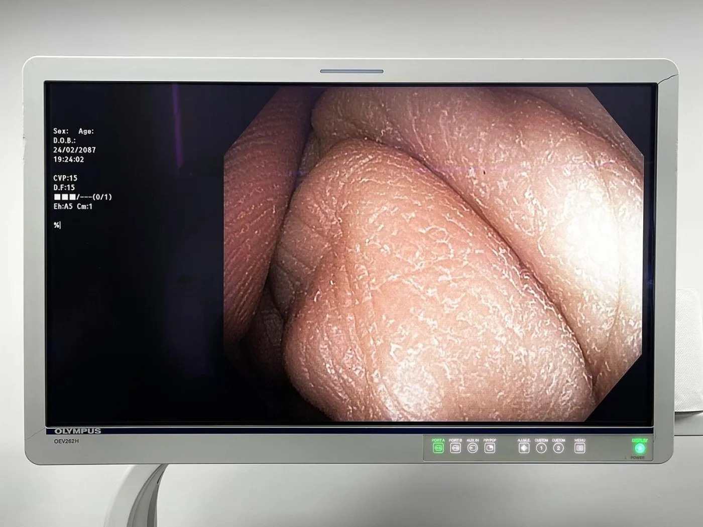 Olympus PCF-H190DL Colonoscopes - 2