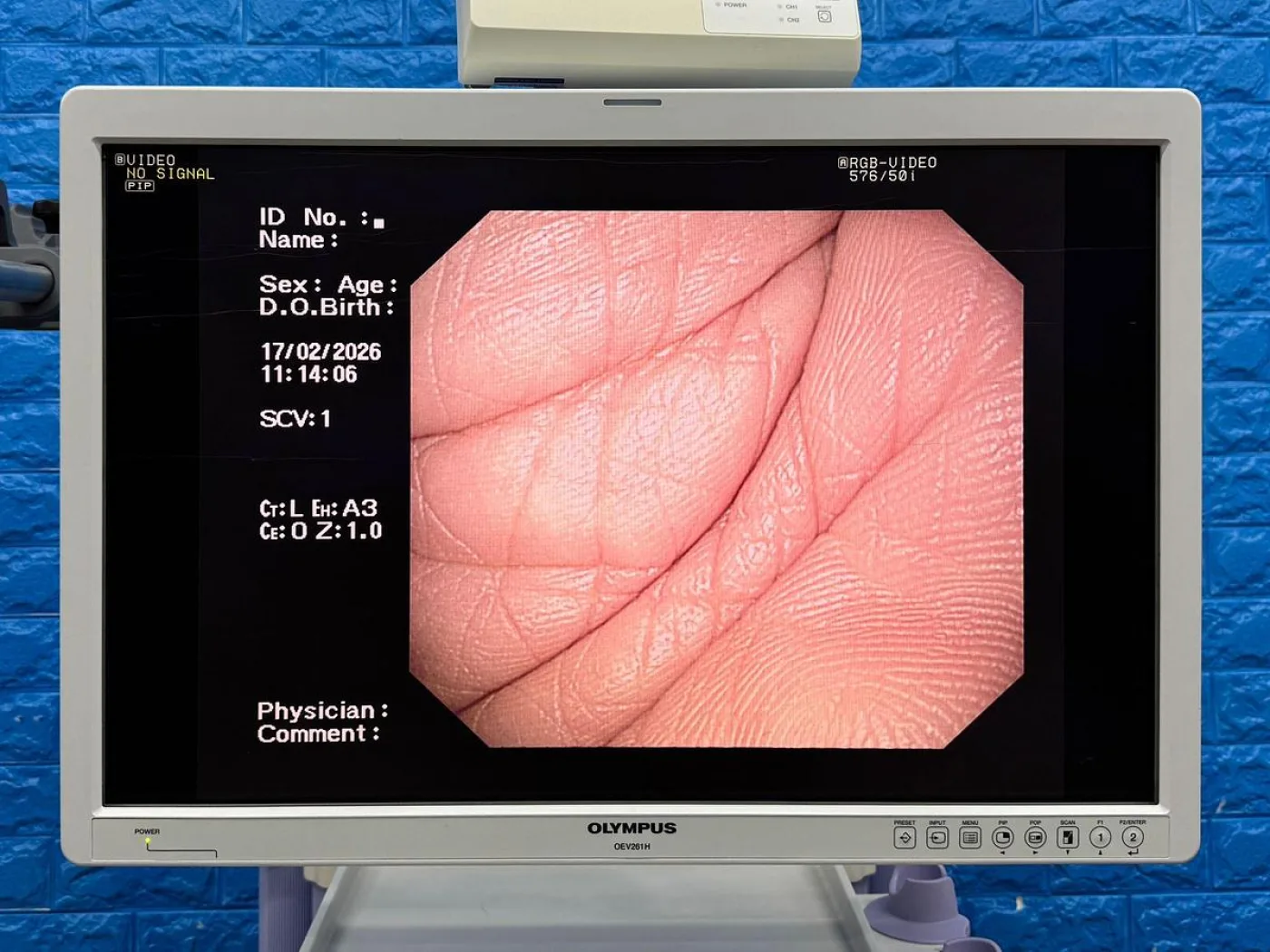 OLYMPUS CV-260SL Endoscopy Tower - 6