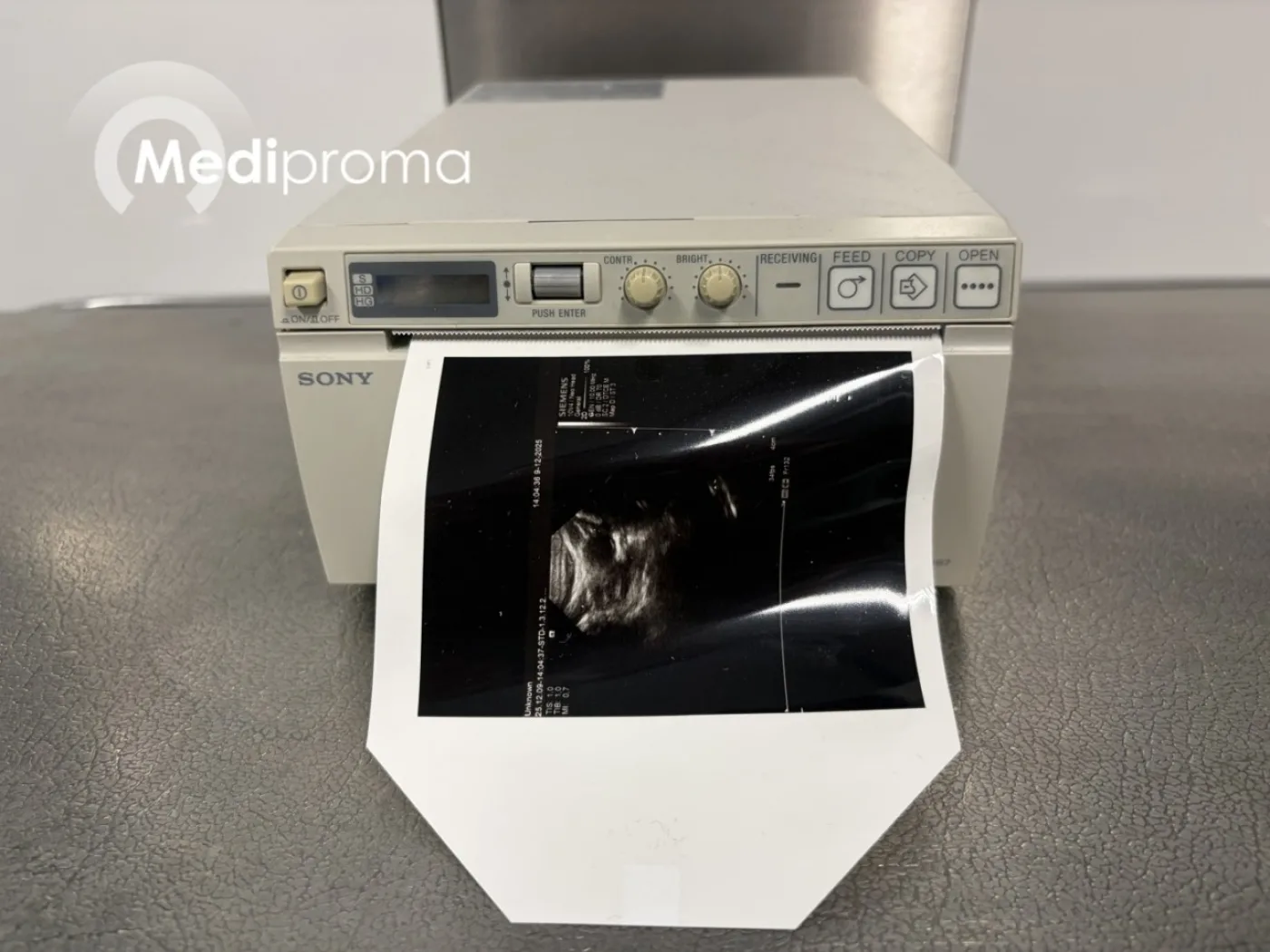 Sony UP-D897 Printer - 1