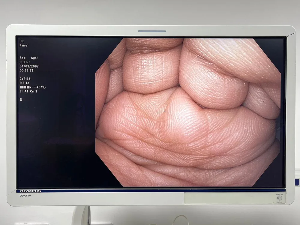 Olympus GIF HQ190 Gastroscope