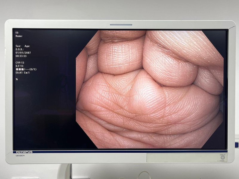 Olympus GIF HQ190 Gastroscope