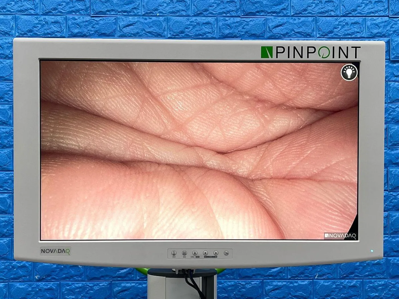Pinpoint Laparoscopy Tower YOM: 2018 - 7