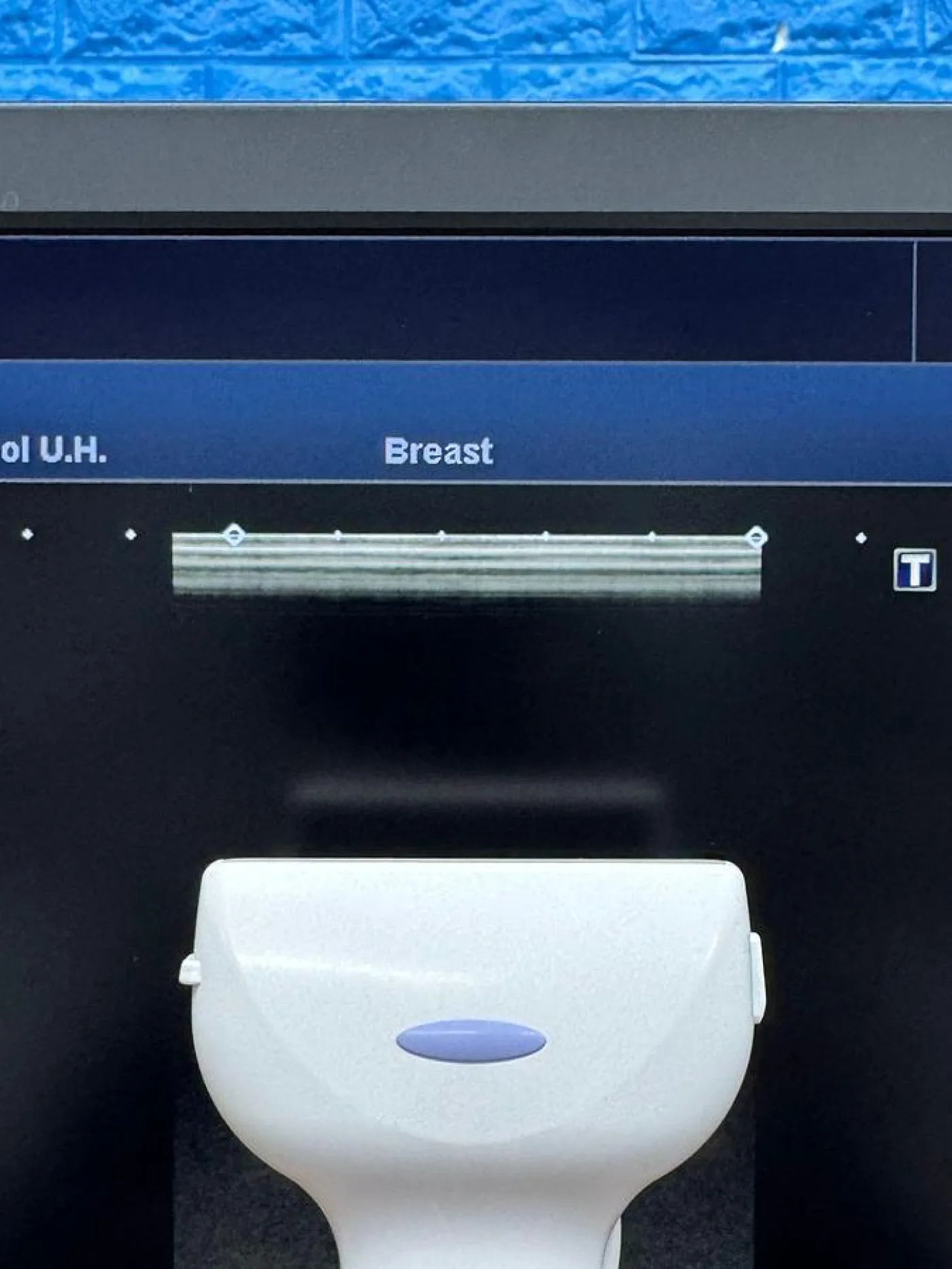 Toshiba Canon Aplio 500 MSK Ultrasound with 3x probes YOM: 2019 - 8
