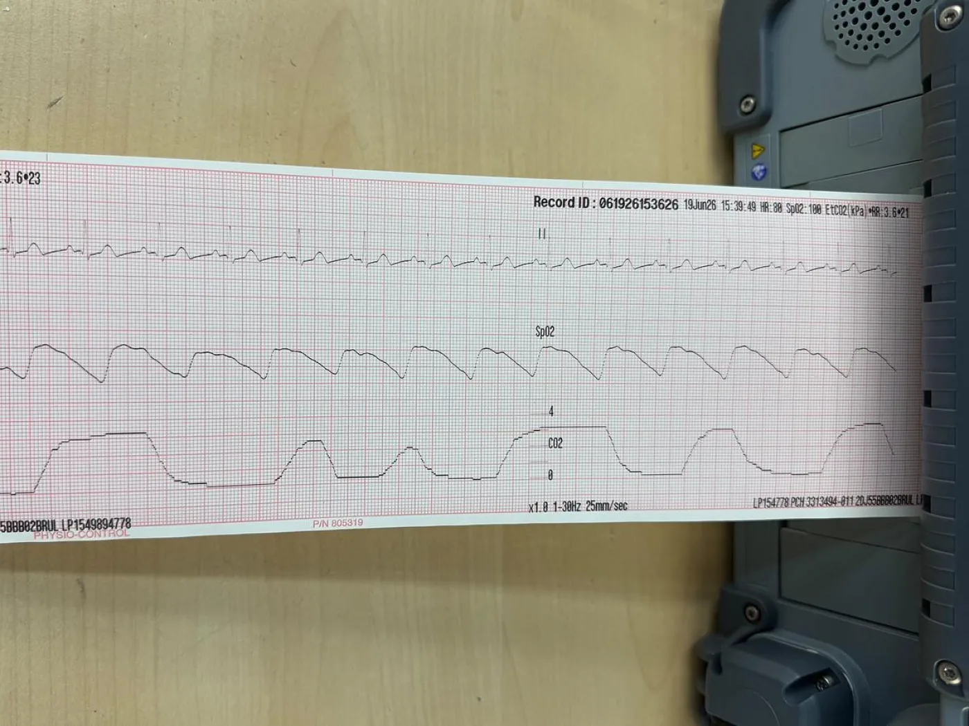 Physio Control Lifepak 15 Defibrillator REF: 99577-001418 YOM: 2022 - 7